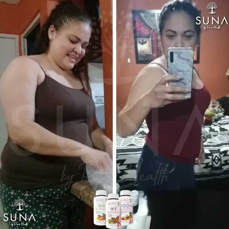 Antes y después de una clienta de Trío SUNA