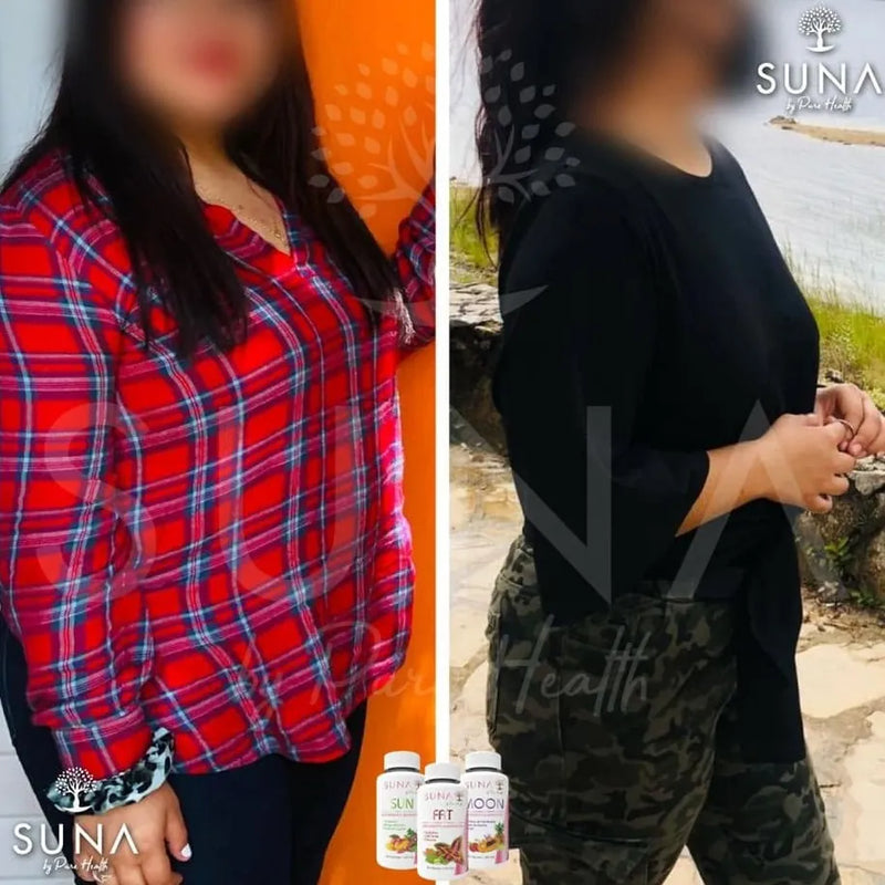 Antes y después de una clienta de Trío SUNA