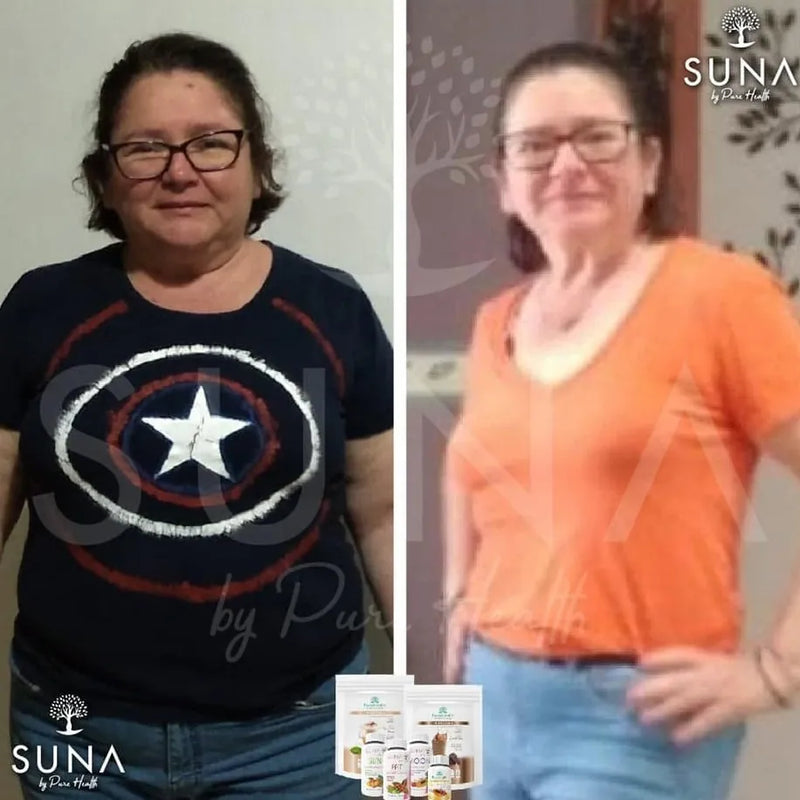 Antes y después de una clienta de Trío SUNA