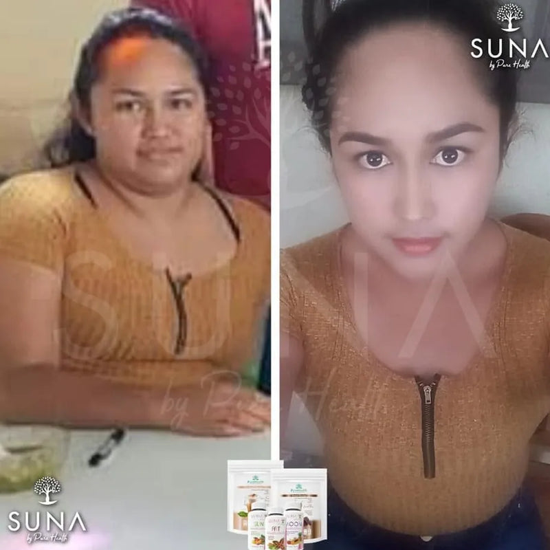 Antes y después de una clienta de Trío SUNA