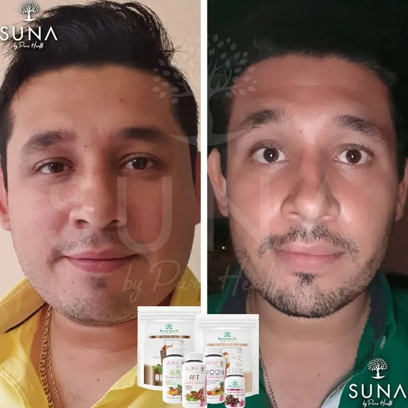 Antes y después de una clienta de Trío SUNA