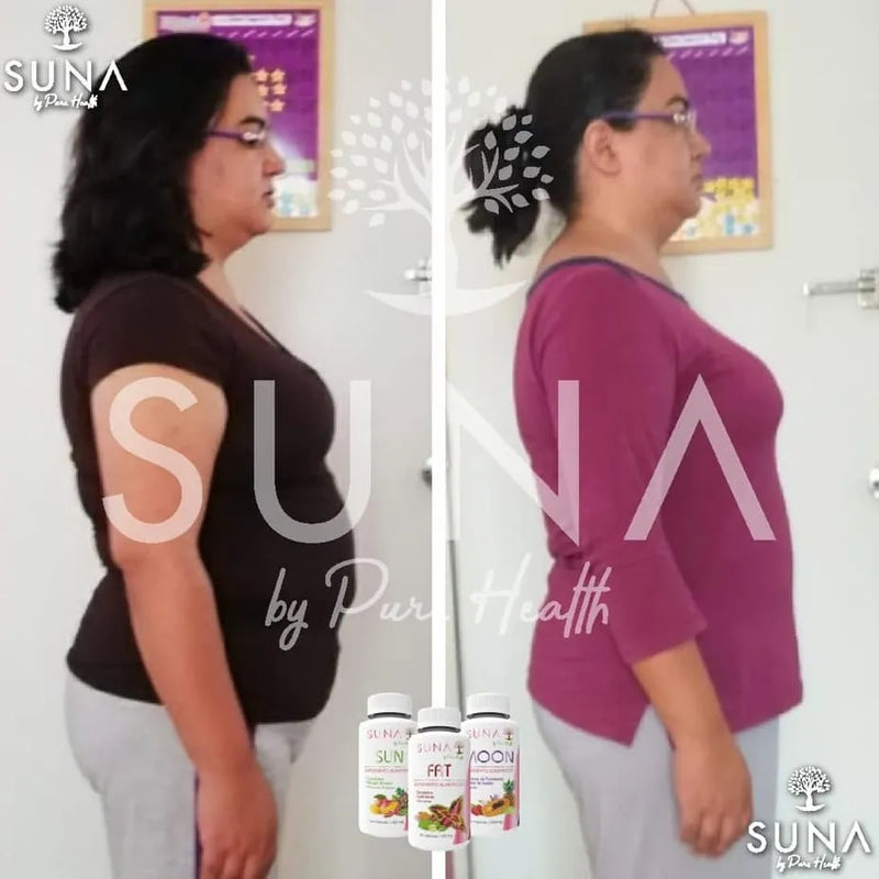 Antes y después de una clienta de Trío SUNA