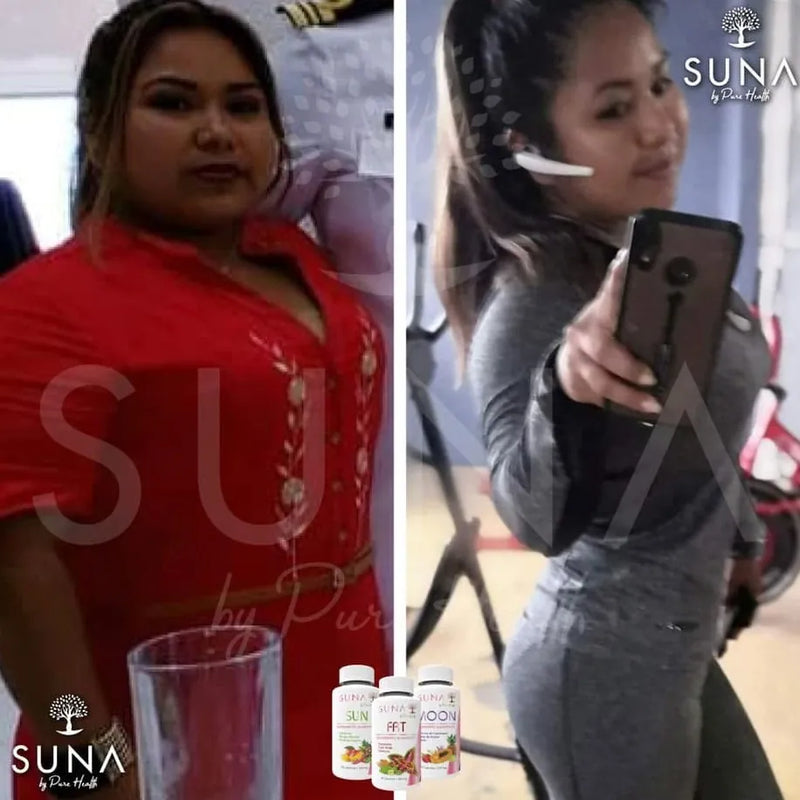 Antes y después de una clienta de Trío SUNA