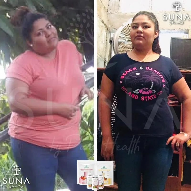 Antes y después de una clienta de Trío SUNA