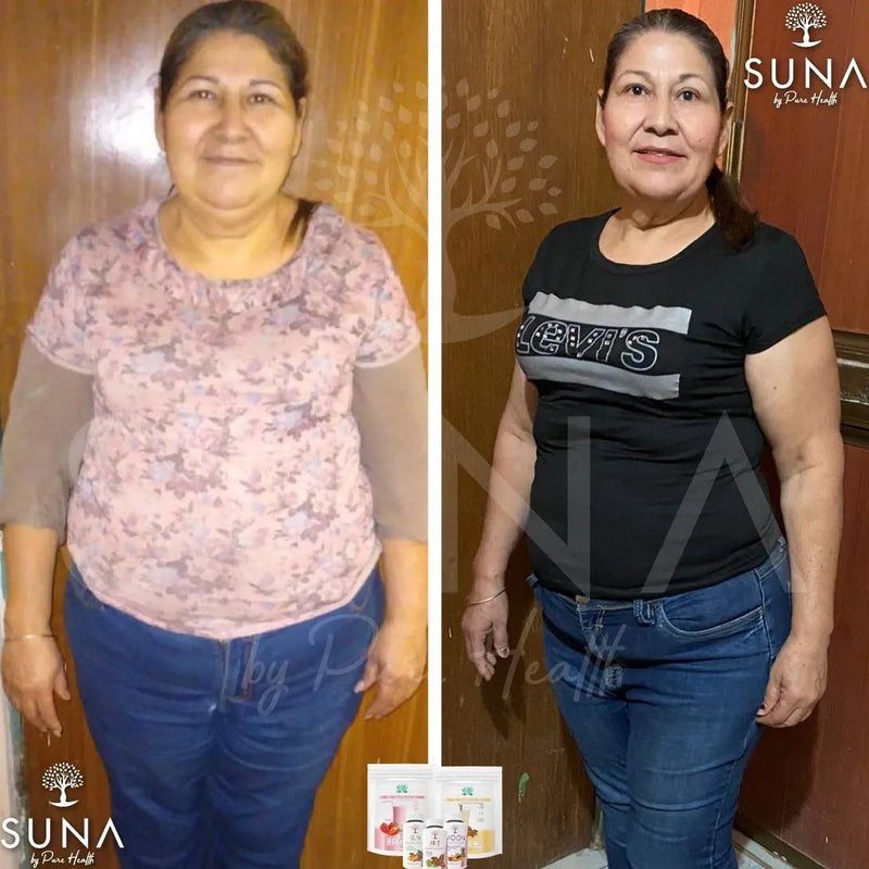 Antes y después de una clienta de Trío SUNA