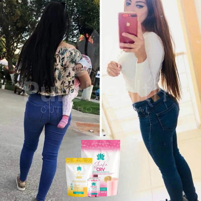 Antes y después de una clienta de Shake CRV y CRV Caps y Collagen ADV Mango