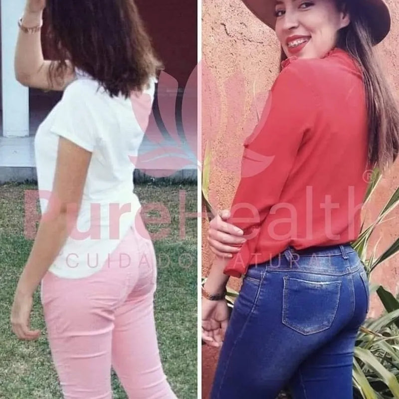 Antes y después de una clienta de Shake CRV y CRV Caps
