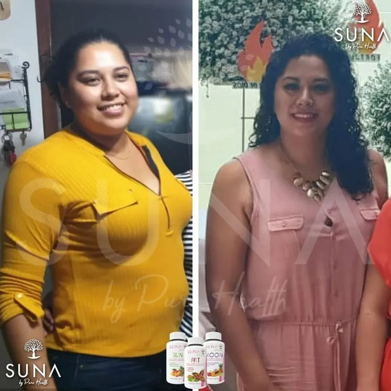 Antes y después de una clienta de Trío SUNA
