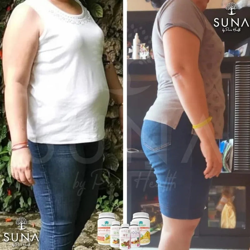 Antes y después de una clienta de Trío SUNA