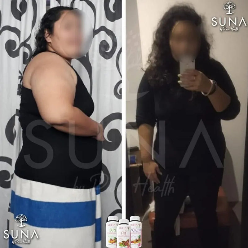 Antes y después de una clienta de Trío SUNA