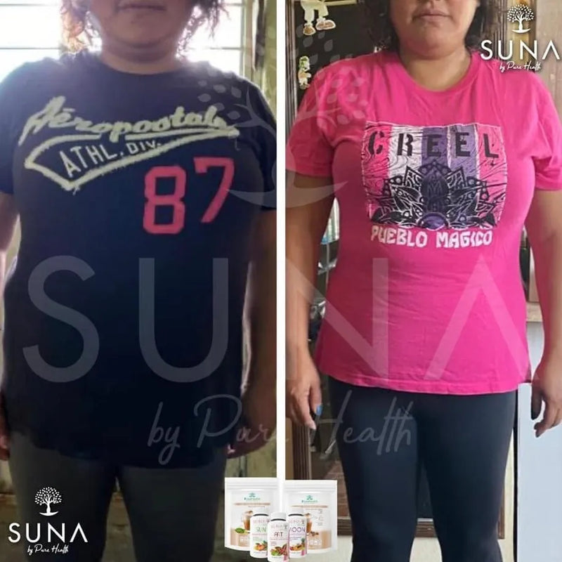 Antes y después de una clienta de Trío SUNA